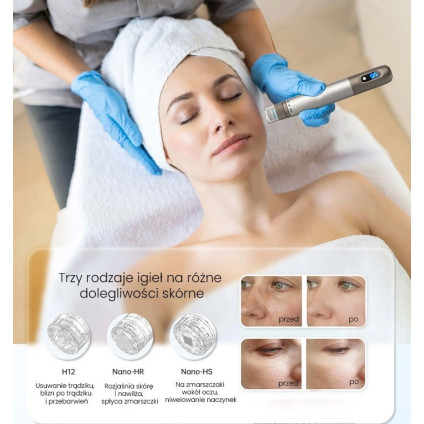 Прибор для мезотерапии Beautifly SkinRenew Pro